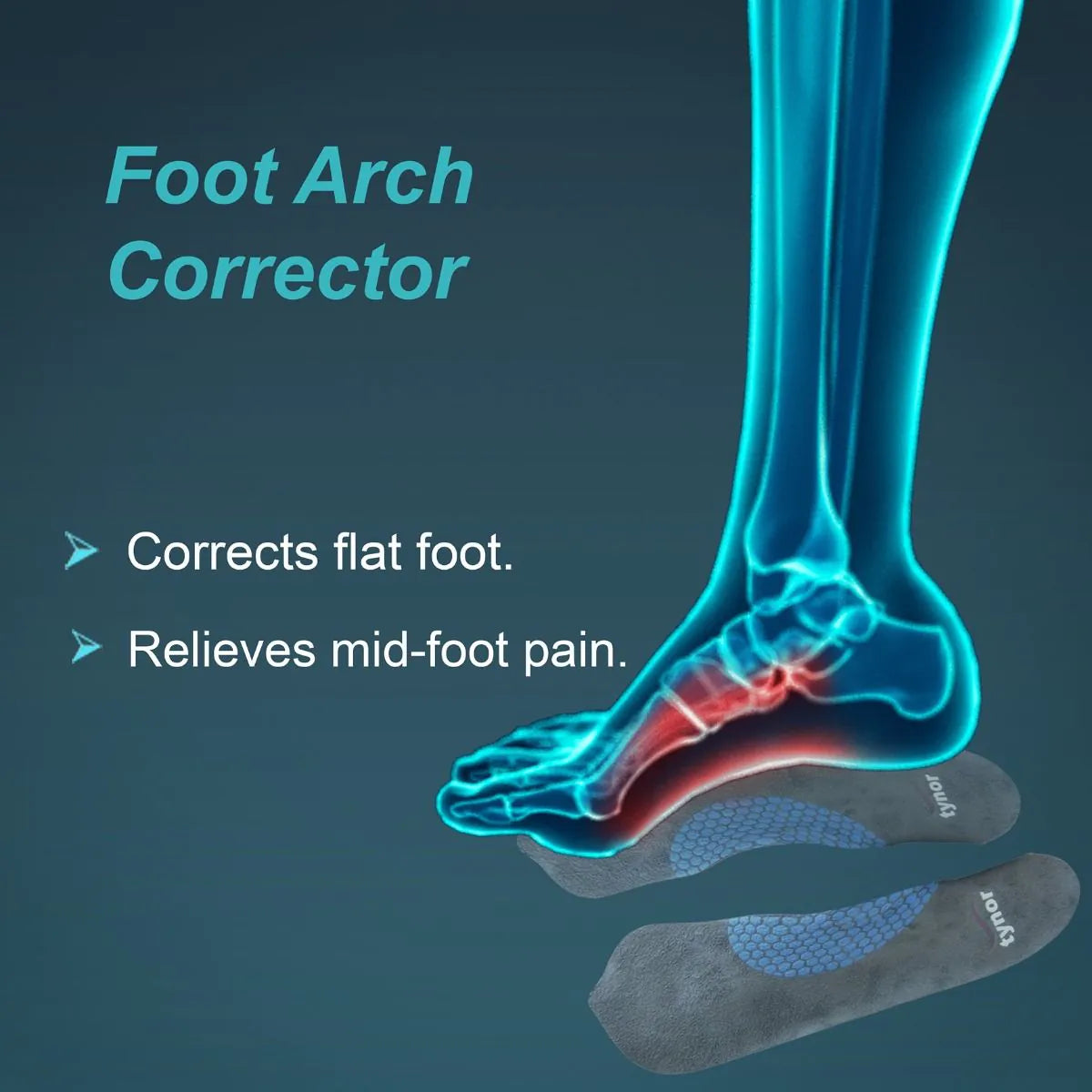 Medial Arch Orthosis