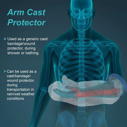 Cast Cover Arm