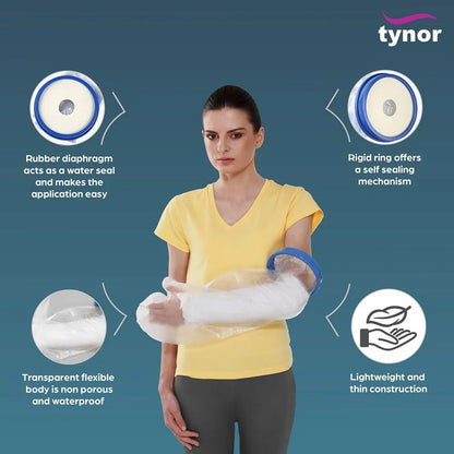 Cast Cover Arm