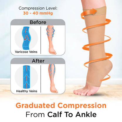 Medical Compression Stocking - Class 2 Knee Length | Mild Support | Improves Blood Circulation | Swollen | Tired | Aching Legs (Beige)